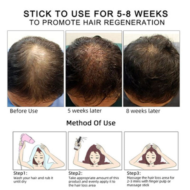 Premium Haarwachstumsöl - Kraftvolle Anti-Haarausfall Formel 30ml