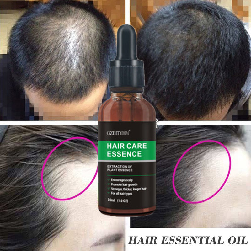 Premium Haarwachstumsöl - Kraftvolle Anti-Haarausfall Formel 30ml